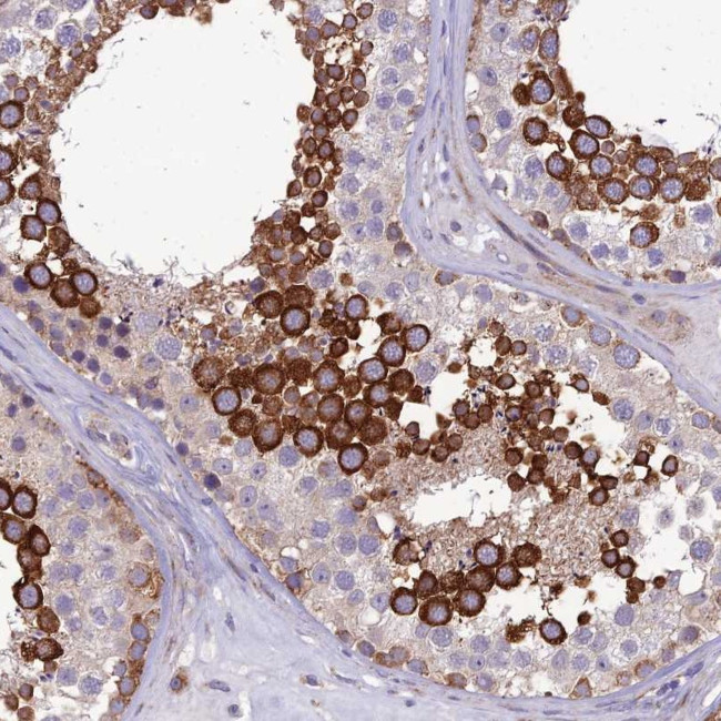 Nodal Antibody in Immunohistochemistry (Paraffin) (IHC (P))