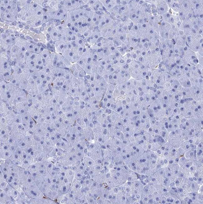 CRYAB Antibody in Immunohistochemistry (Paraffin) (IHC (P))