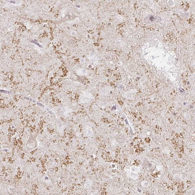 GluR3 Antibody in Immunohistochemistry (Paraffin) (IHC (P))