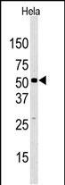 JMJD2D Antibody in Western Blot (WB)