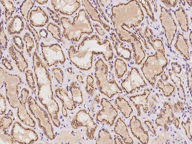 YIPF4 Antibody in Immunohistochemistry (Paraffin) (IHC (P))