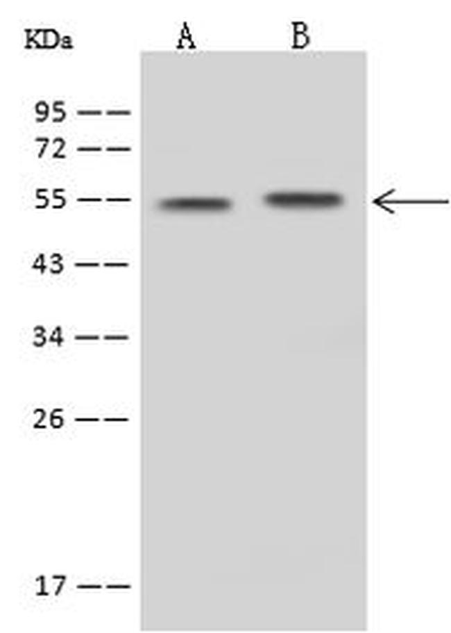 SLC30A10 Antibody in Western Blot (WB)