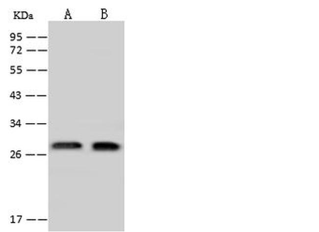 EXOSC4 Antibody in Western Blot (WB)