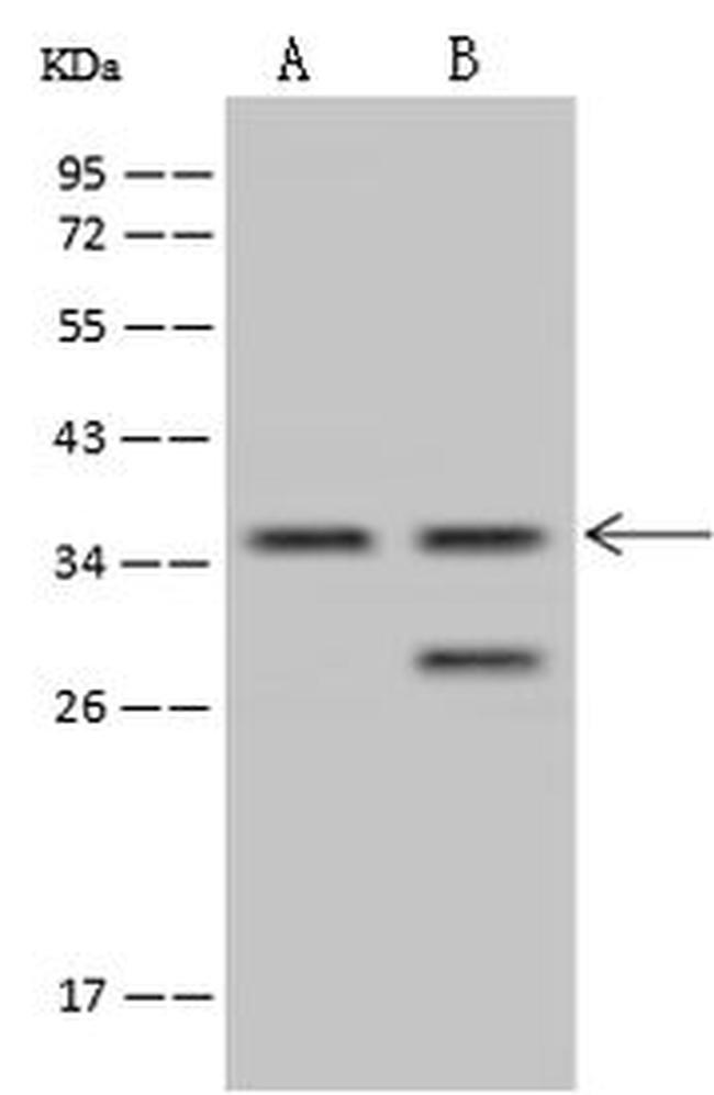 TSEN34 Antibody in Western Blot (WB)