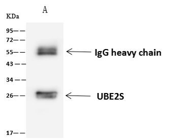 UBE2S Antibody in Immunoprecipitation (IP)
