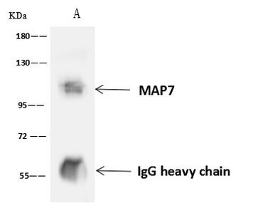 MAP7 Antibody in Immunoprecipitation (IP)