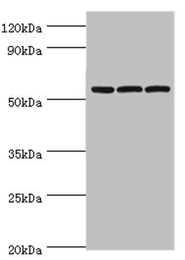 alpha Amylase 2B Antibody in Western Blot (WB)