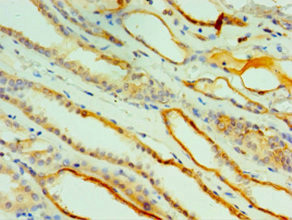 Cathepsin V Antibody in Immunohistochemistry (Paraffin) (IHC (P))