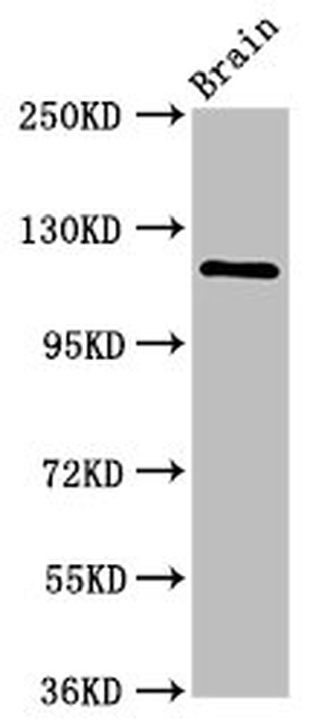 HIP1R Antibody in Western Blot (WB)