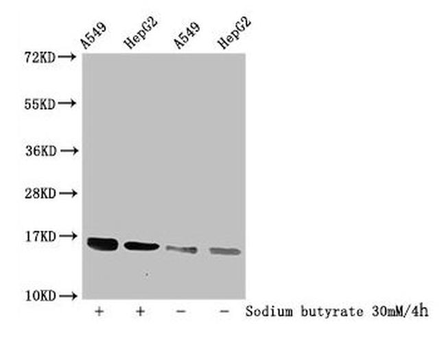 H3K56mal Antibody in Western Blot (WB)