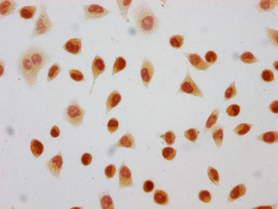 2-hydroxyisobutyryl-Histone H4 (Lys8) Antibody in Immunocytochemistry (ICC/IF)