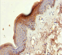 Cytokeratin 6A Antibody in Immunohistochemistry (Paraffin) (IHC (P))