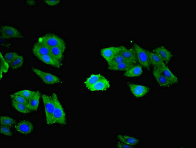 NXF5 Antibody in Immunocytochemistry (ICC/IF)