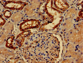 PALM Antibody in Immunohistochemistry (Paraffin) (IHC (P))