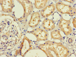 RHD Antibody in Immunohistochemistry (Paraffin) (IHC (P))