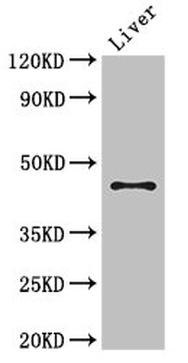 RHD Antibody in Western Blot (WB)