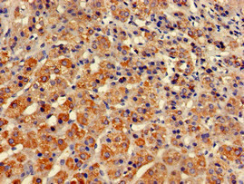 STXBP3 Antibody in Immunohistochemistry (Paraffin) (IHC (P))