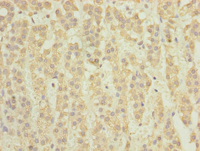 TCTA Antibody in Immunohistochemistry (Paraffin) (IHC (P))