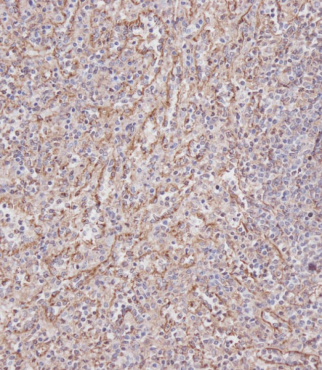 IFITM3 Antibody in Immunohistochemistry (Paraffin) (IHC (P))