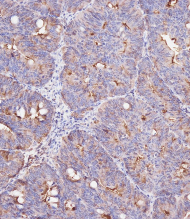 IFITM3 Antibody in Immunohistochemistry (Paraffin) (IHC (P))