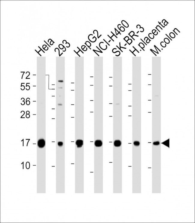 IFITM3 Antibody in Western Blot (WB)