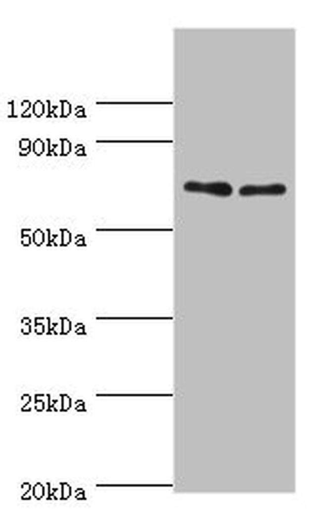 DR6 Antibody in Western Blot (WB)