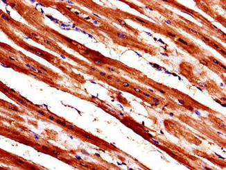 WISP1 Antibody in Immunohistochemistry (Paraffin) (IHC (P))