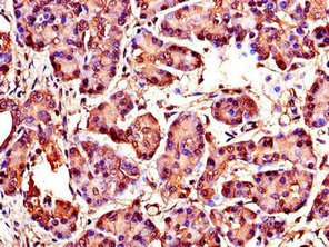 WISP1 Antibody in Immunohistochemistry (Paraffin) (IHC (P))