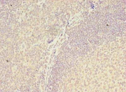 ZNF238 Antibody in Immunohistochemistry (Paraffin) (IHC (P))