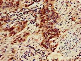 ZNF695 Antibody in Immunohistochemistry (Paraffin) (IHC (P))