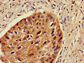 ZNF695 Antibody in Immunohistochemistry (Paraffin) (IHC (P))