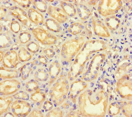 B4GALT5 Antibody in Immunohistochemistry (Paraffin) (IHC (P))