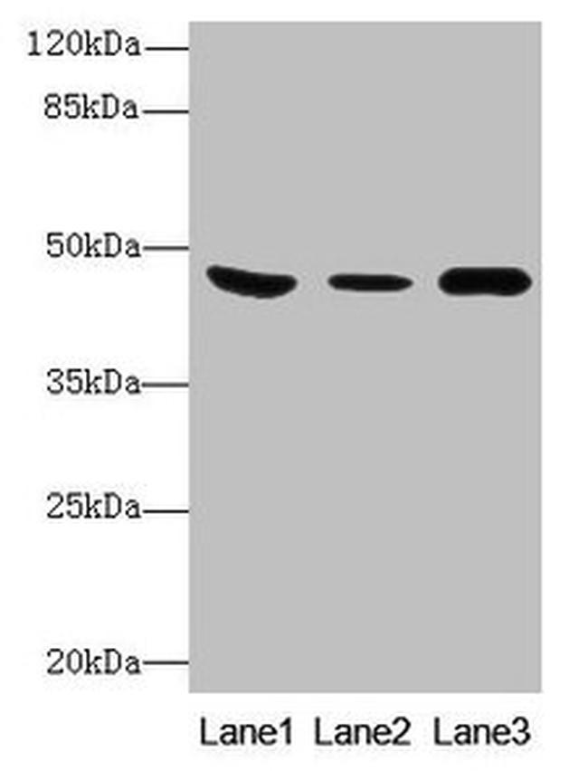 B4GALT5 Antibody in Western Blot (WB)