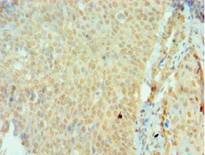 SSX2 Antibody in Immunohistochemistry (Paraffin) (IHC (P))