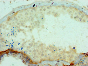 SSX2 Antibody in Immunohistochemistry (Paraffin) (IHC (P))