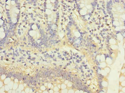 C5orf22 Antibody in Immunohistochemistry (Paraffin) (IHC (P))