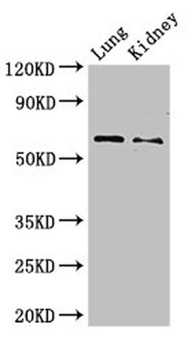PLBD2 Antibody in Western Blot (WB)