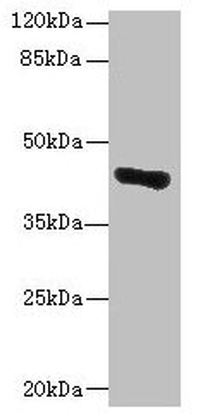 GLT8D1 Antibody in Western Blot (WB)