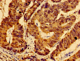 AHSA2 Antibody in Immunohistochemistry (Paraffin) (IHC (P))