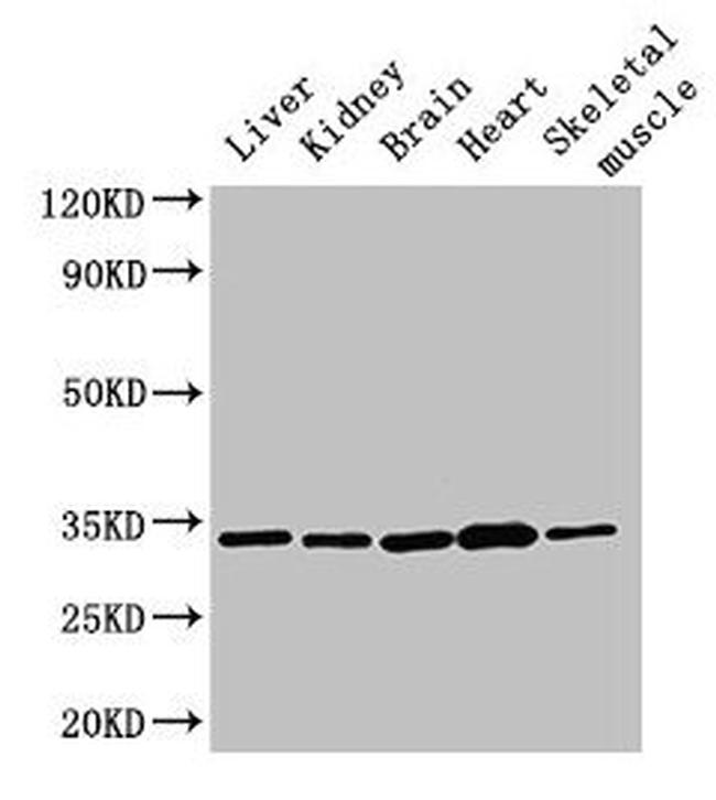 AHSA2 Antibody in Western Blot (WB)