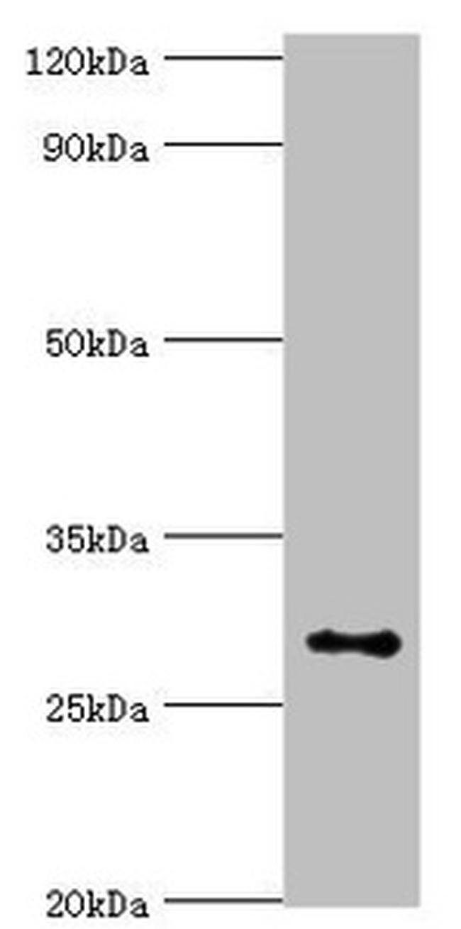 ALKBH2 Antibody in Western Blot (WB)