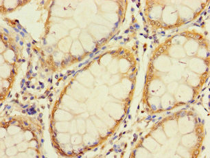 UNC93A Antibody in Immunohistochemistry (Paraffin) (IHC (P))