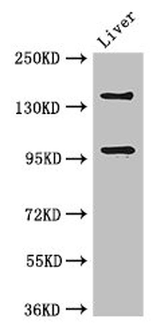 PHLDB2 Antibody in Western Blot (WB)