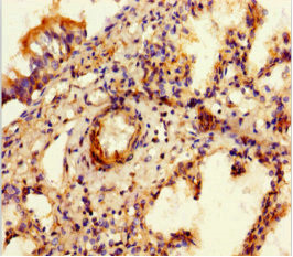 SULF1 Antibody in Immunohistochemistry (Paraffin) (IHC (P))