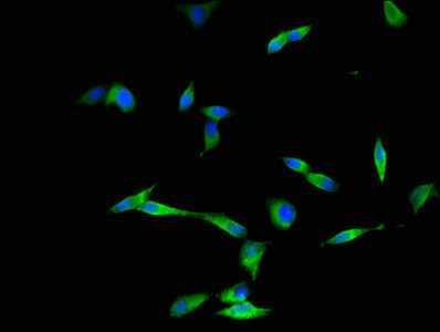 DYNC2H1 Antibody in Immunocytochemistry (ICC/IF)