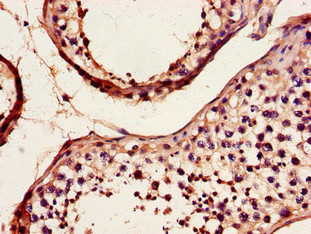 DYNC2H1 Antibody in Immunohistochemistry (Paraffin) (IHC (P))