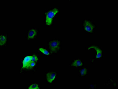 SLC5A5 Antibody in Immunocytochemistry (ICC/IF)