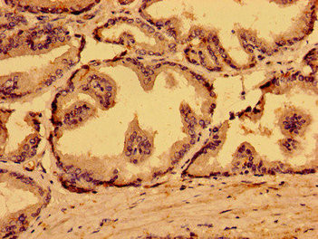 MARS2 Antibody in Immunohistochemistry (Paraffin) (IHC (P))