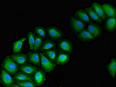 VPS39 Antibody in Immunocytochemistry (ICC/IF)