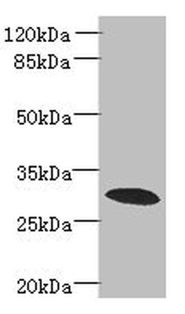 PDCL2 Antibody in Western Blot (WB)